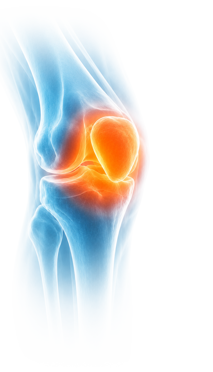 Ilustración 3D de articulación de rodilla con punto de dolor iluminado